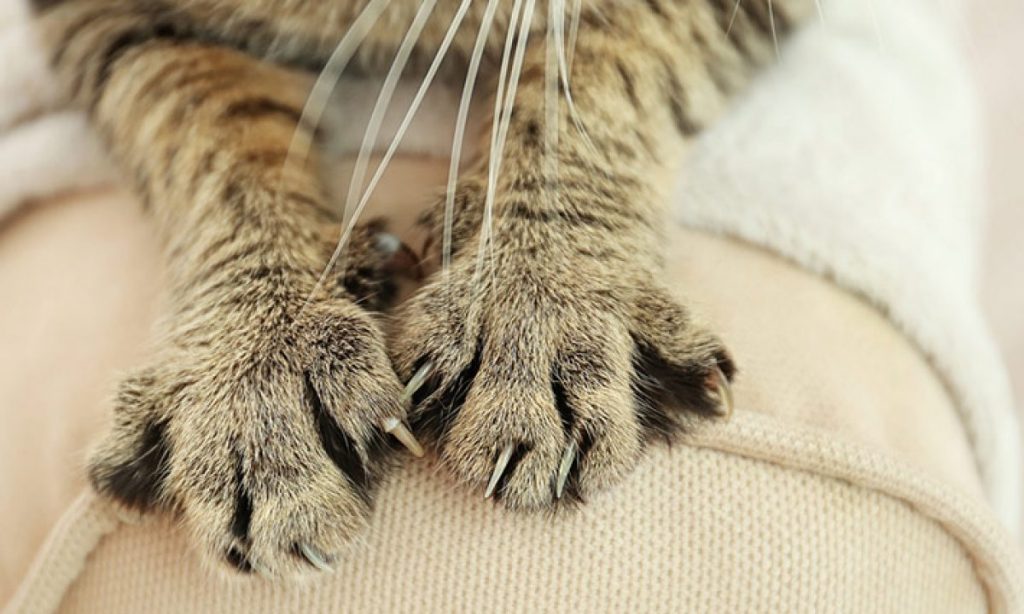 Kedi Tırmalamasına Ne Yapılır? Yeni Nesil Zarif